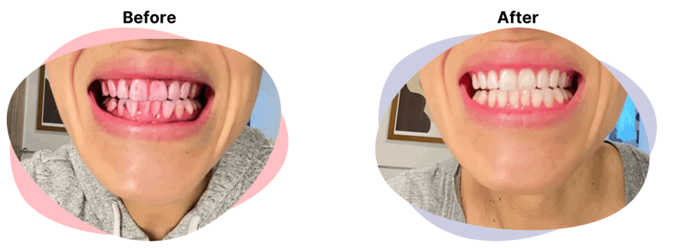 Autobrush – Adult Pro 17